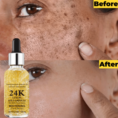 GoldGlow™ 24K Radiance Serum